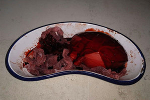 Квест Blood & Organs